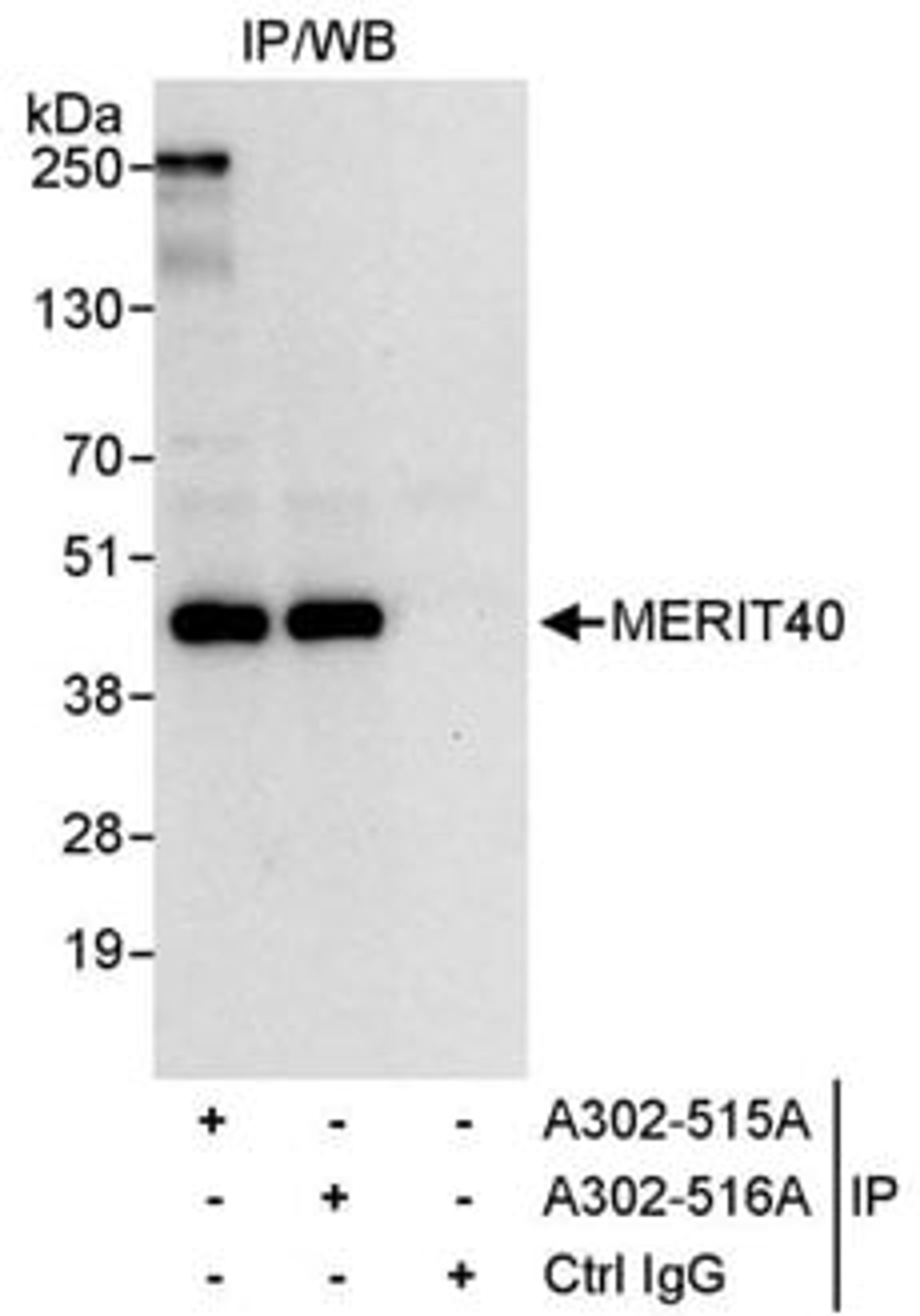 Detection of human MERIT40 by western blot of immunoprecipitates.