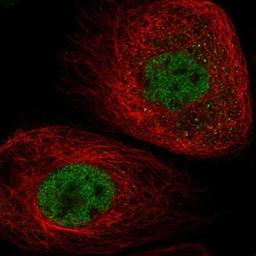 Immunocytochemistry/Immunofluorescence: ATAD2B Antibody [NBP1-89611] - Staining of human cell line A-431 shows positivity in nucleus but not nucleoli.