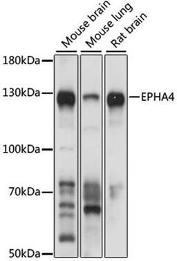 Western blot - EPHA4 antibody (A8346)