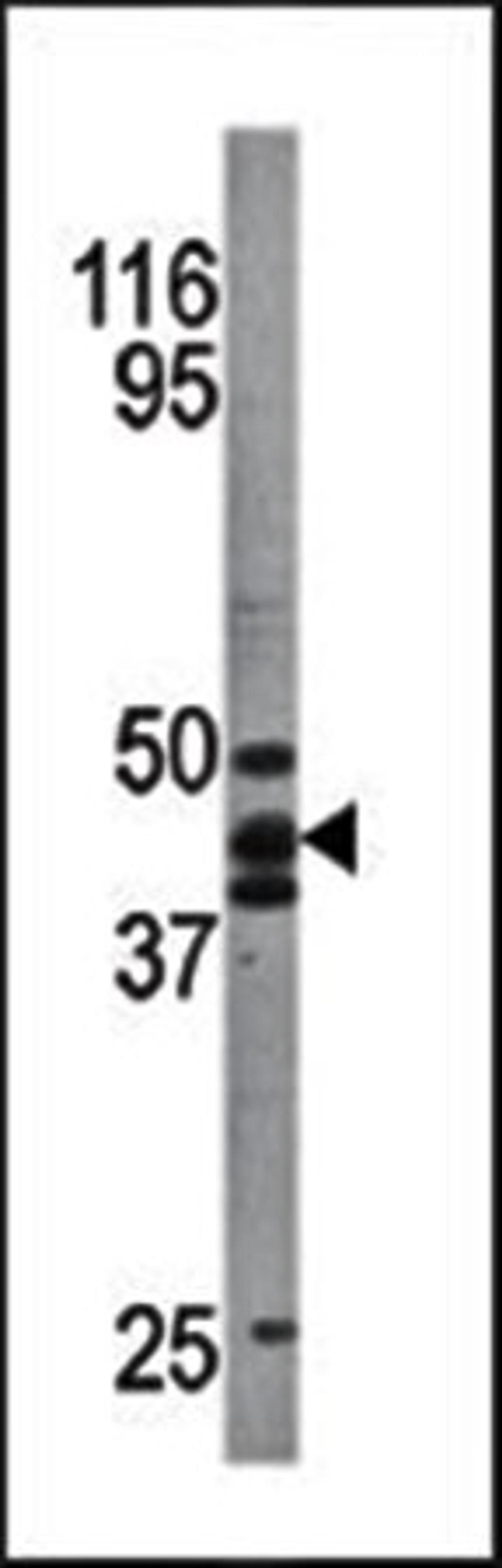 Western blot analysis of hp53 antibody in A2058 cell line lysates