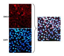 Localization of SMC4 to Mitotic Chromosomes by immunocytochemistry.