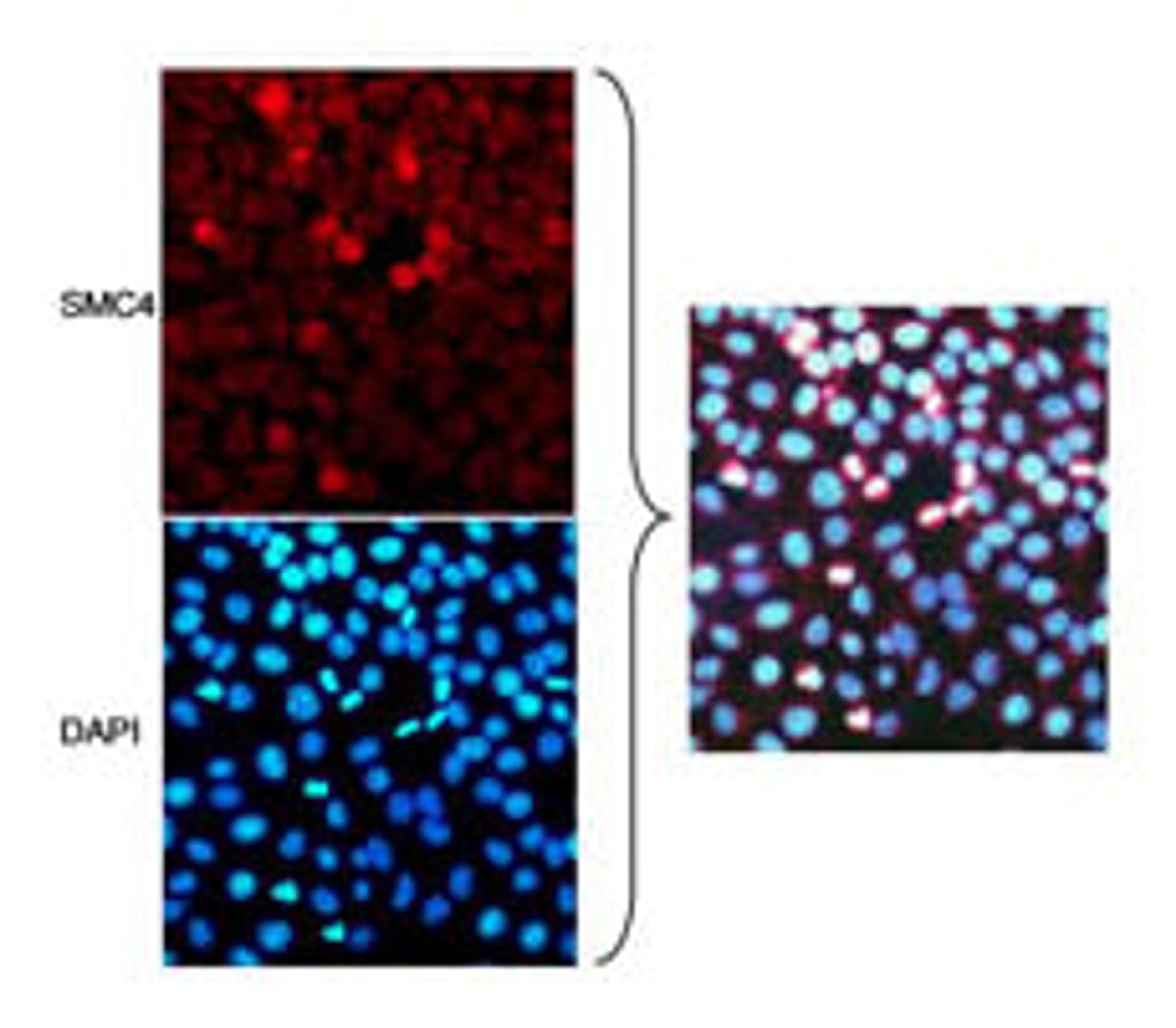 Localization of SMC4 to Mitotic Chromosomes by immunocytochemistry.