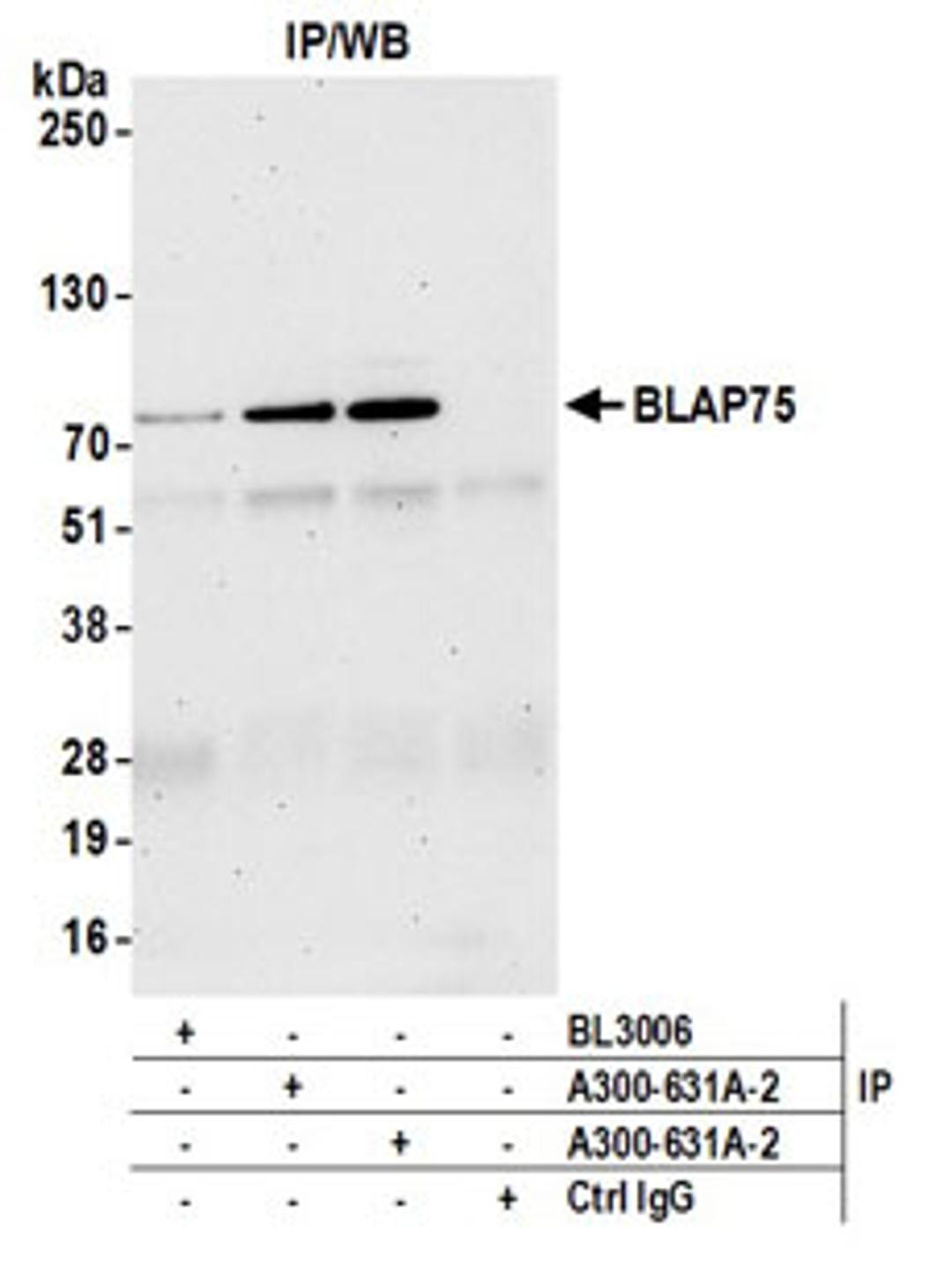 Detection of human BLAP75 by western blot of immunoprecipitates.