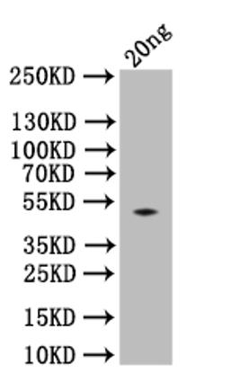 Western Blot. Positive WB detected in: recombinant protein. All lanes:spaA Antibody at 1:1000. Secondary. Goat polyclonal to rabbit IgG at 1/50000 dilution. Predicted band size: 51 kDa. Observed band size: 51 kDa.
