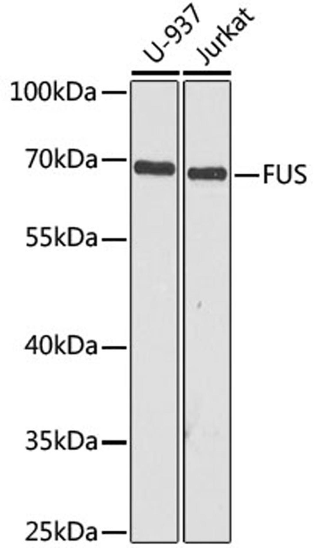 Western blot - FUS antibody (A5921)