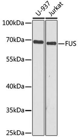 Western blot - FUS antibody (A5921)