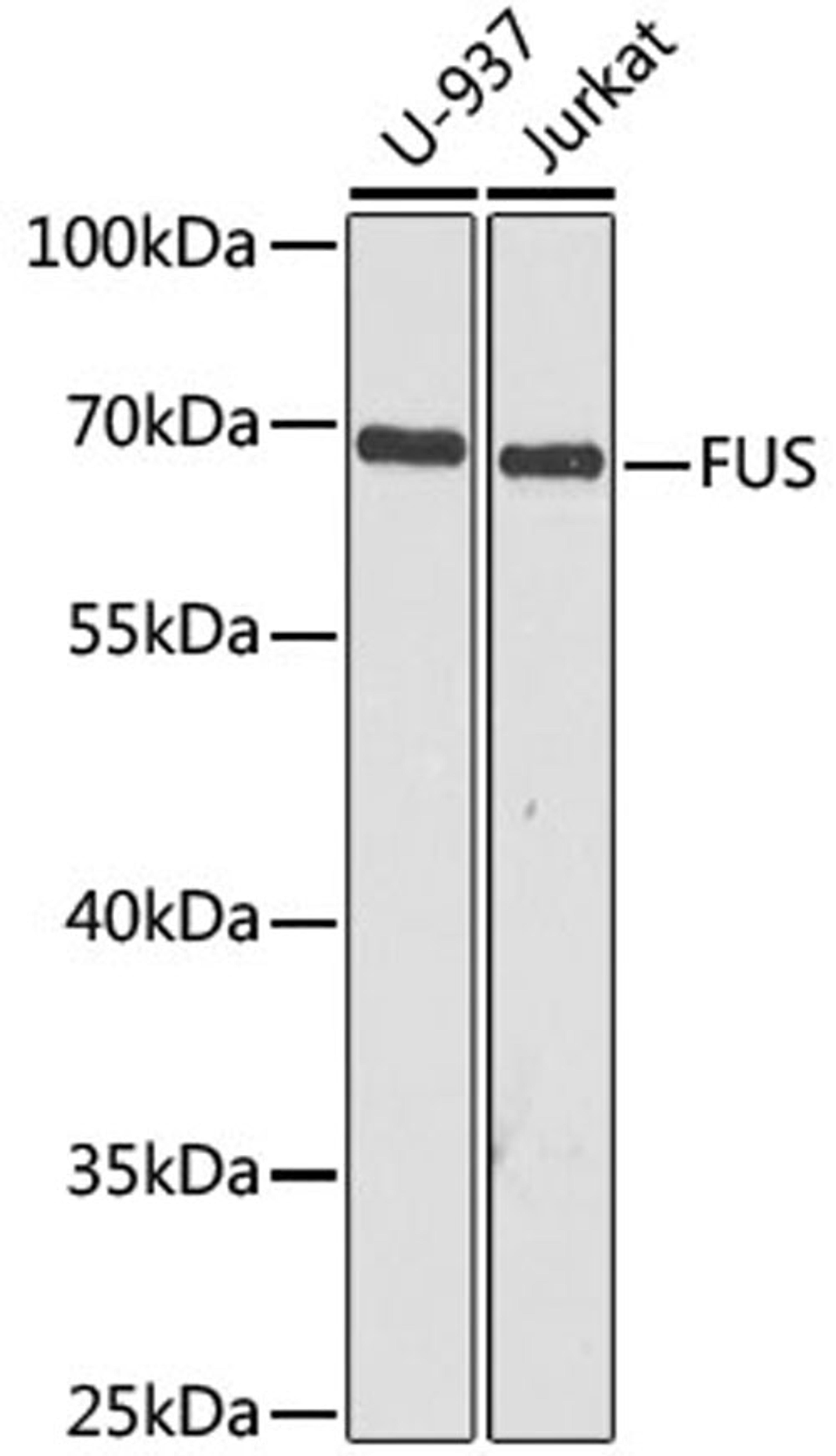 Western blot - FUS antibody (A5921)