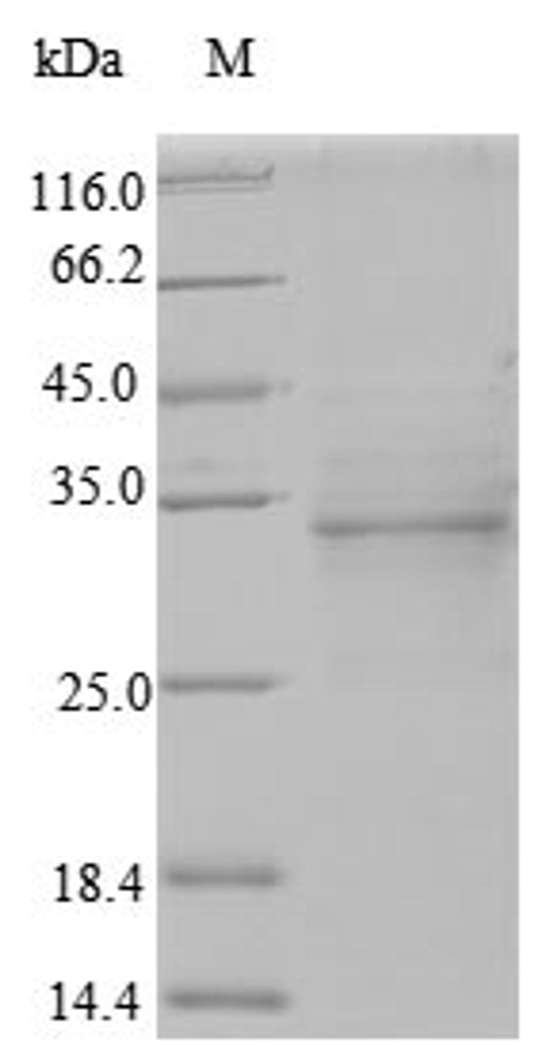 (Tris-Glycine gel) Discontinuous SDS-PAGE (reduced) with 5% enrichment gel and 15% separation gel.