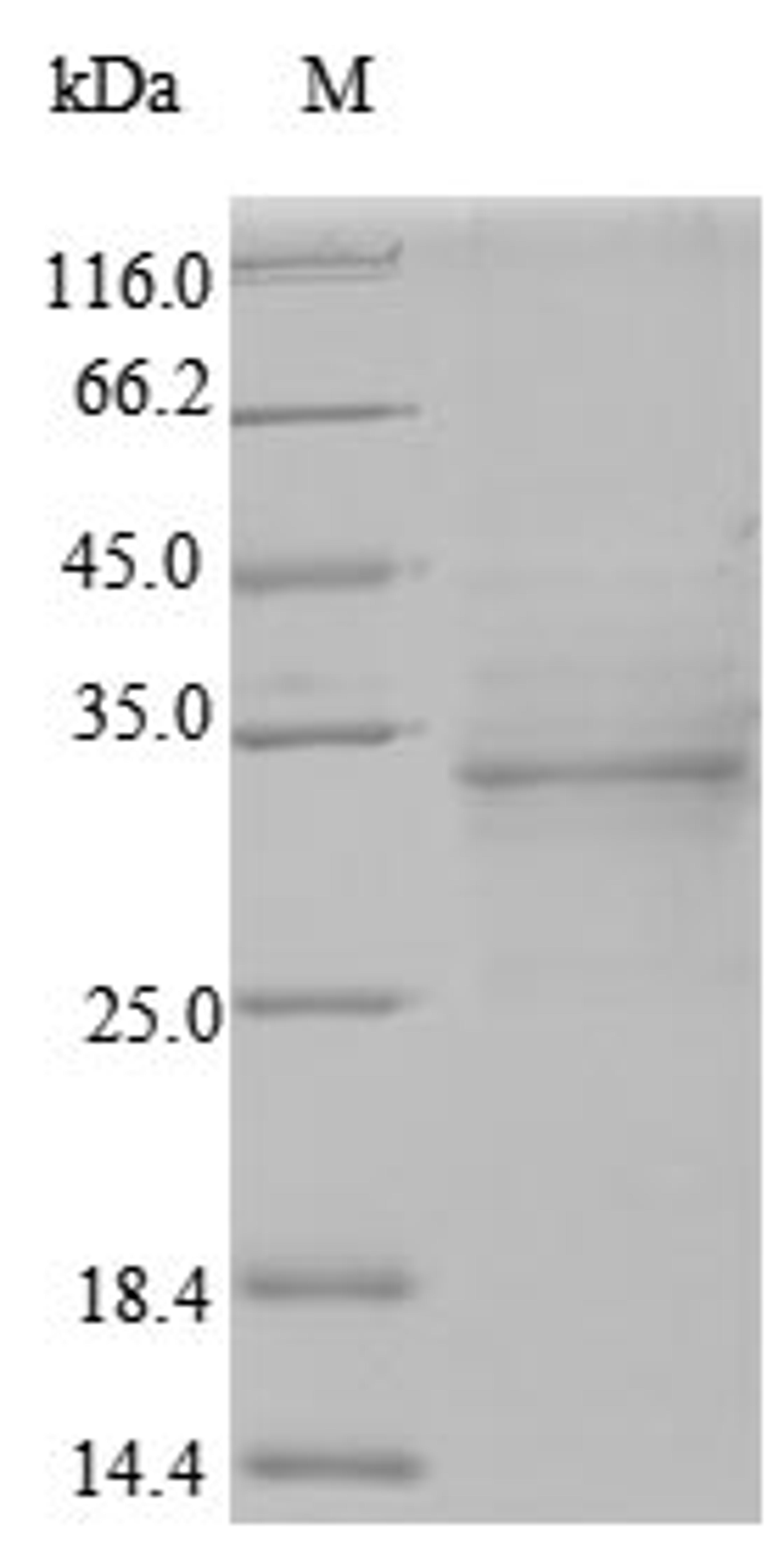 (Tris-Glycine gel) Discontinuous SDS-PAGE (reduced) with 5% enrichment gel and 15% separation gel.