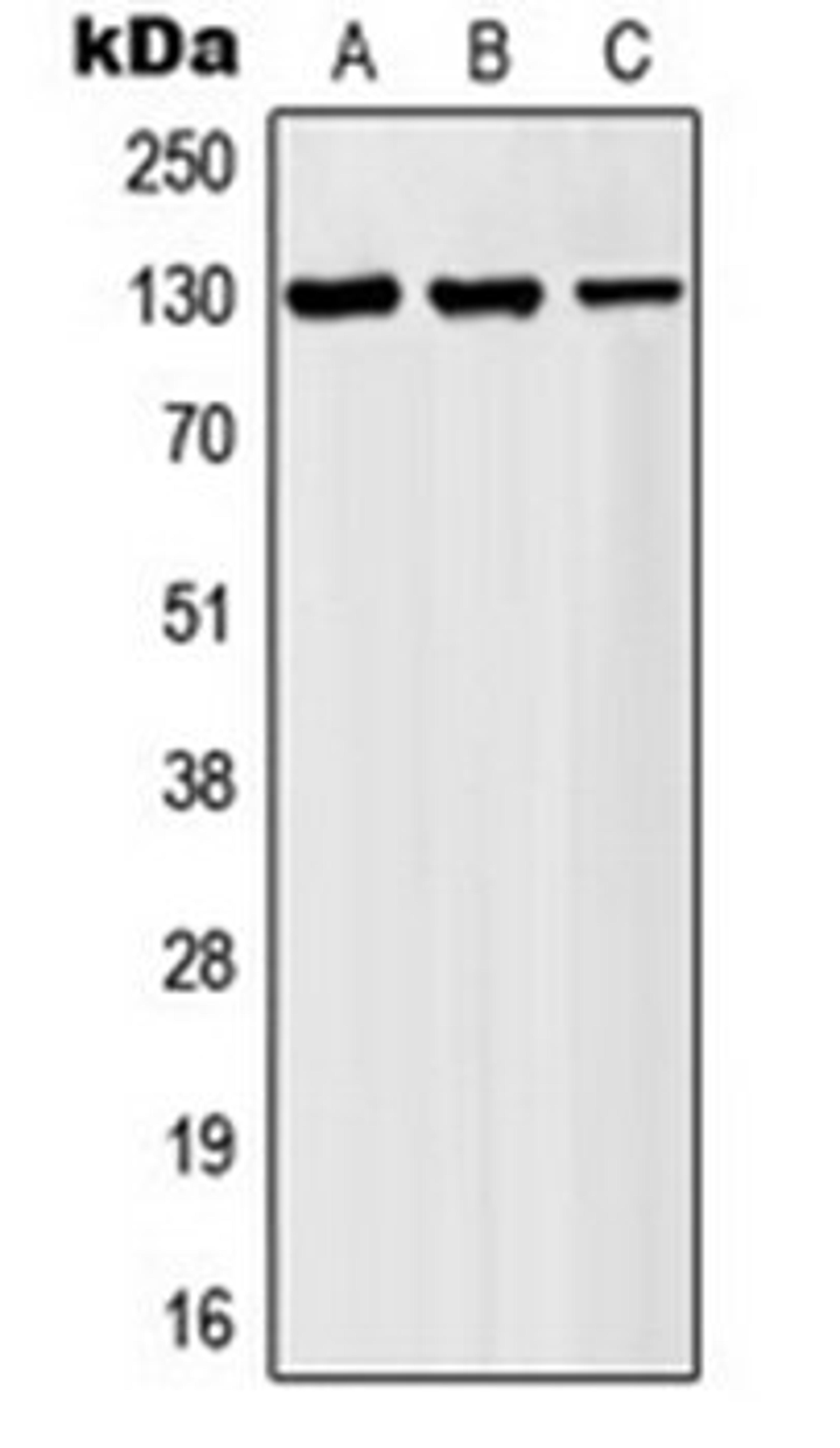 Western blot analysis of HeLa (Lane 1), K562 (Lane 2), Jurkat (Lane 3) whole cell lysates using AFF1 antibody