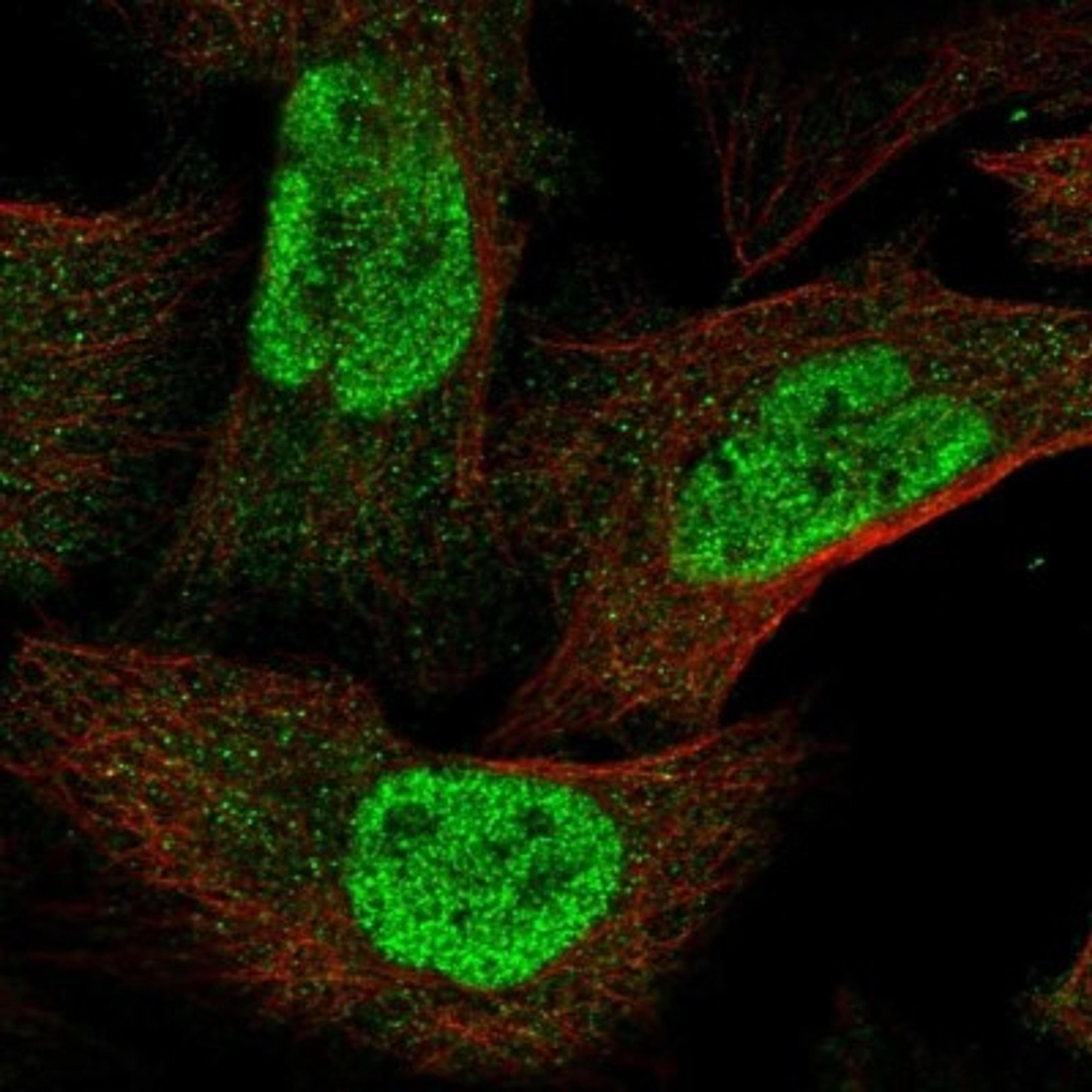 Immunocytochemistry/Immunofluorescence: DALRD3 Antibody [NBP1-84622] - Staining of human cell line U-2 OS shows positivity in nucleus but not nucleoli.