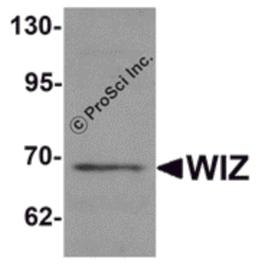 Western blot analysis of WIZ in rat lung tissue lysate with WIZ antibody at 1 μg/mL.