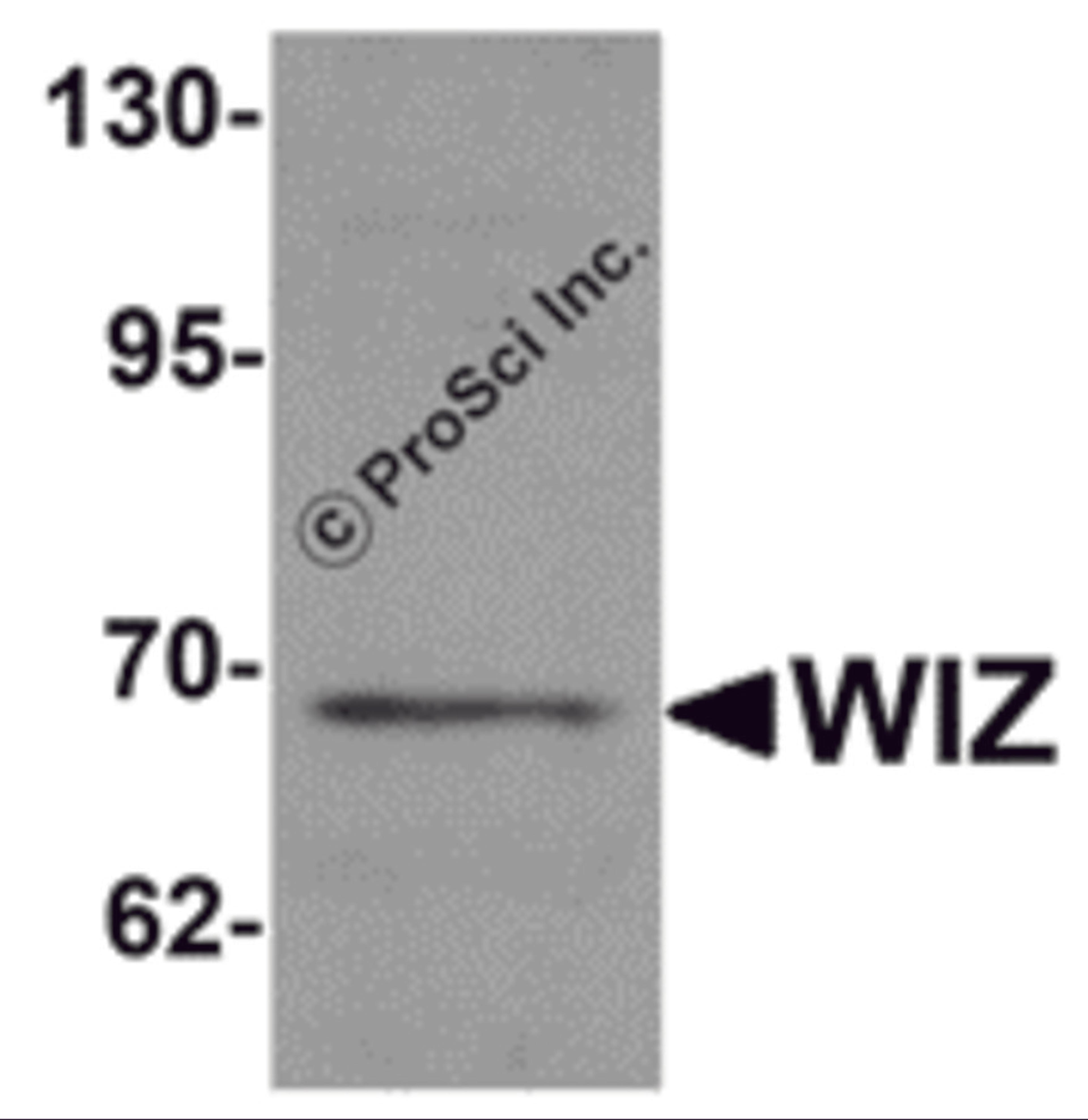 Western blot analysis of WIZ in rat lung tissue lysate with WIZ antibody at 1 μg/mL.