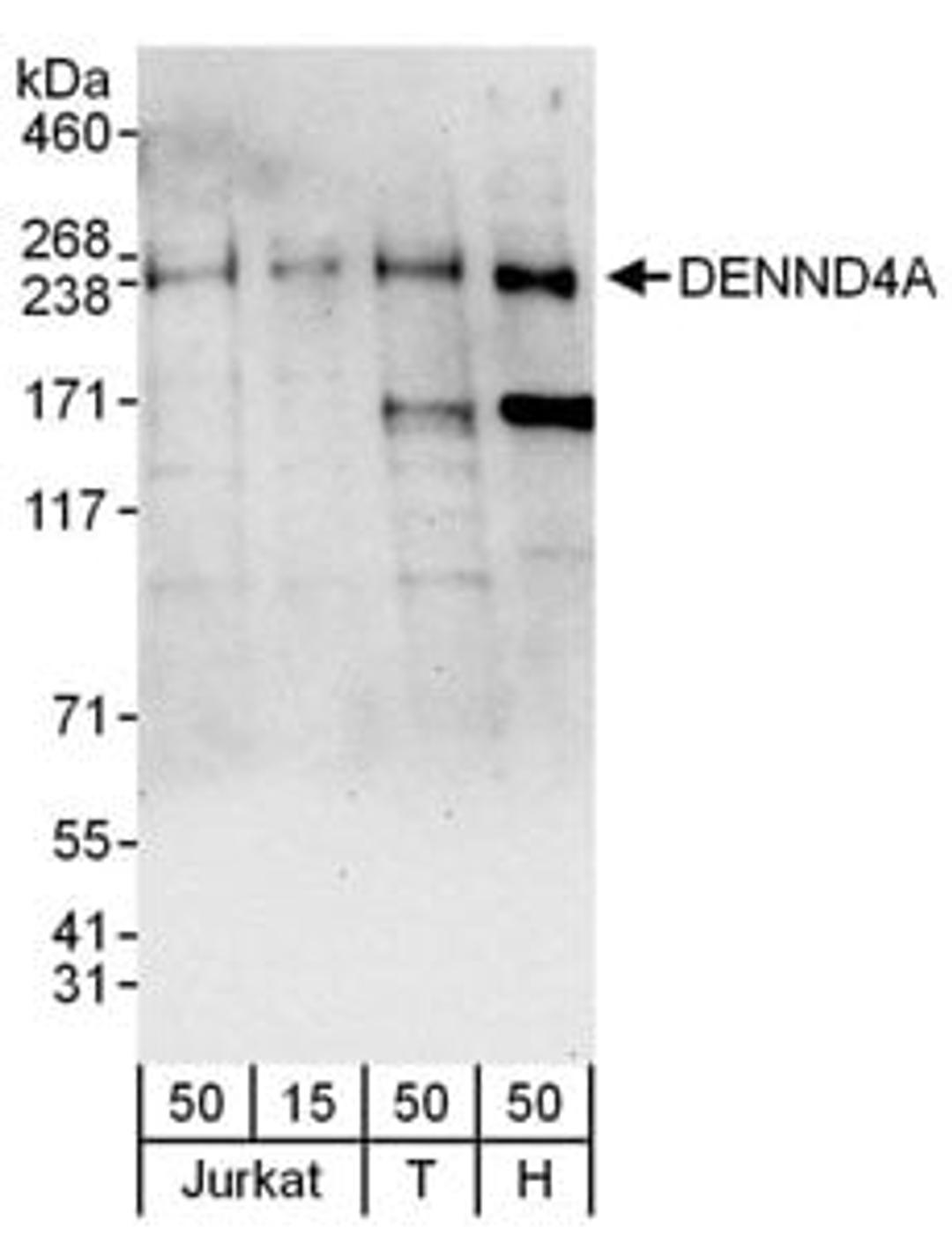 Detection of human DENND4A by western blot.