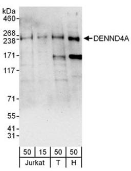 Detection of human DENND4A by western blot.