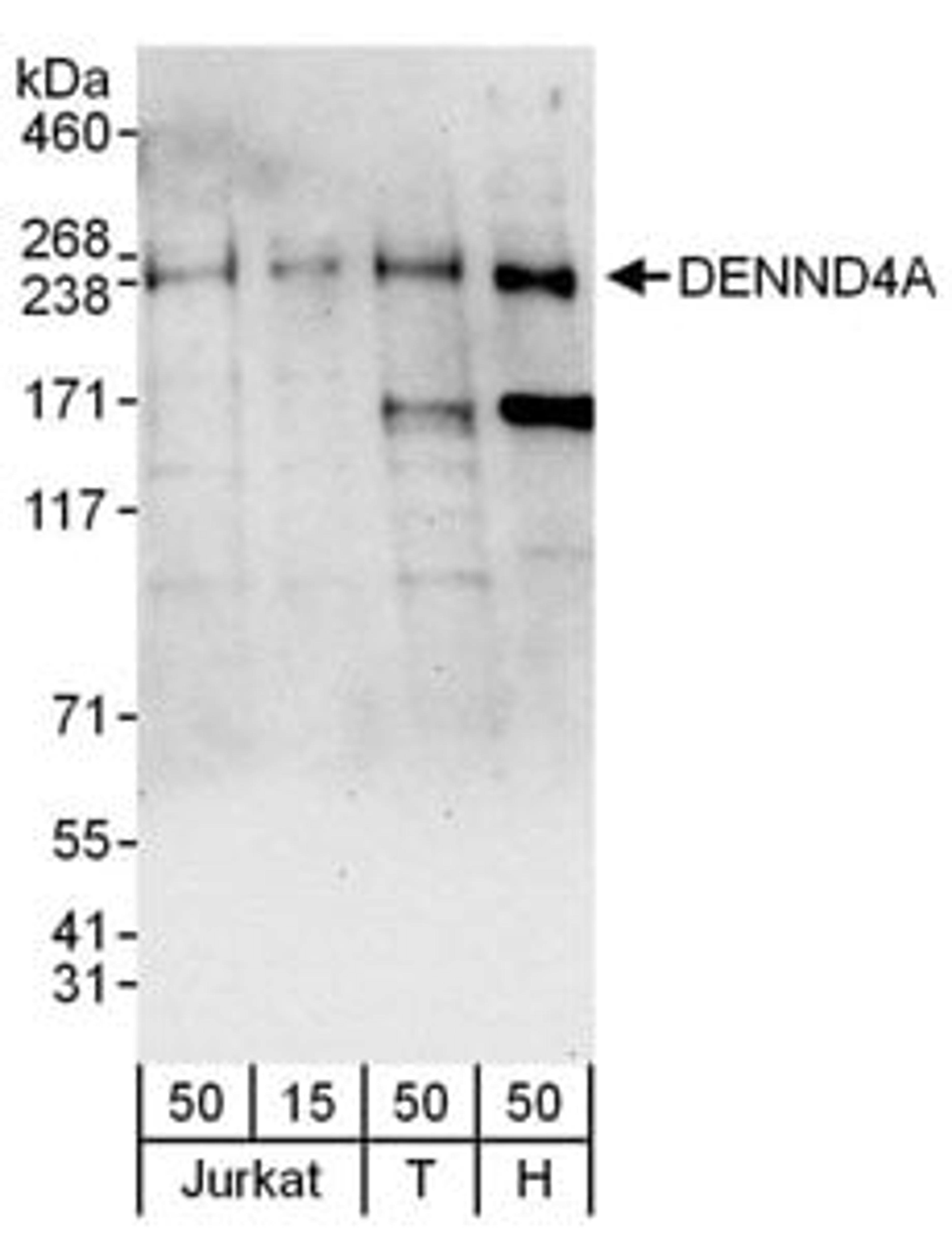 Detection of human DENND4A by western blot.