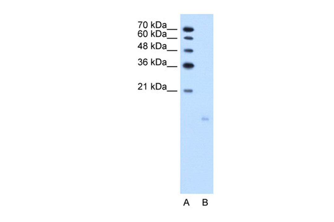 Antibody used in WB on Human Jurkat 2.5 ug/ml.