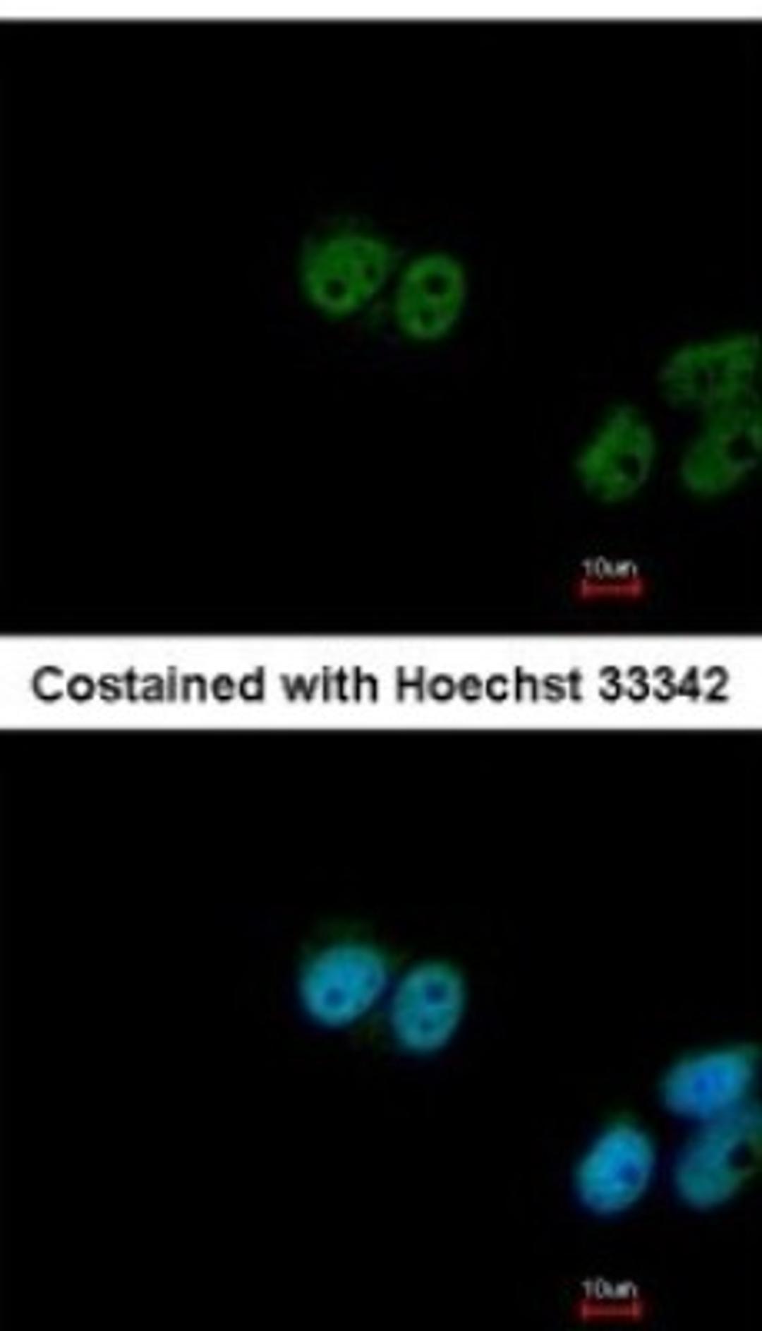 Immunocytochemistry/Immunofluorescence: FUBP3 Antibody [NBP2-16545] - Analysis of paraformaldehyde-fixed MCF-7, using antibody at 1:200 dilution.