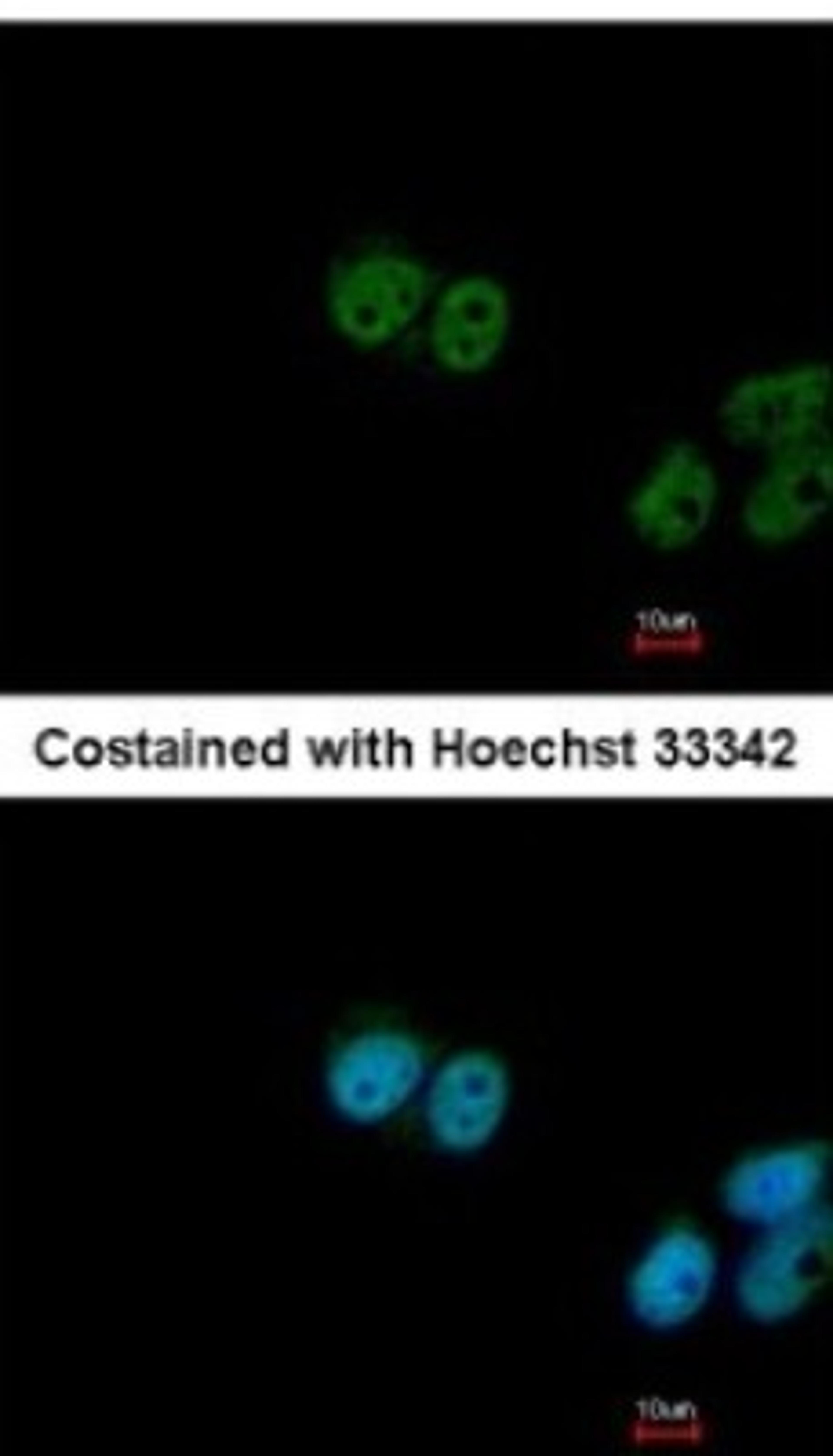 Immunocytochemistry/Immunofluorescence: FUBP3 Antibody [NBP2-16545] - Analysis of paraformaldehyde-fixed MCF-7, using antibody at 1:200 dilution.