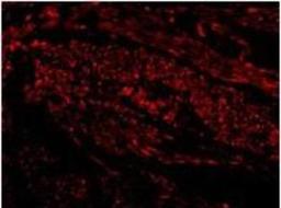 Immunocytochemistry/Immunofluorescence: TIM-1/KIM-1/HAVCR Antibody [NBP1-76701] - in Human Uterus cells. Dilution  20 ug/mL.