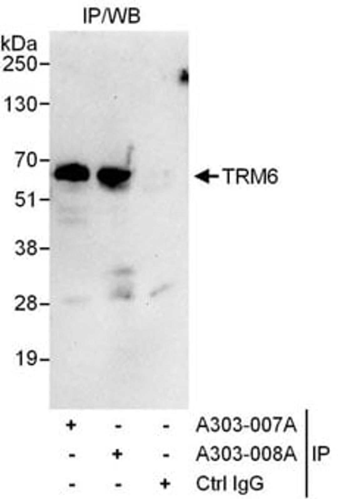 Detection of human TRM6 by western blot of immunoprecipitates.