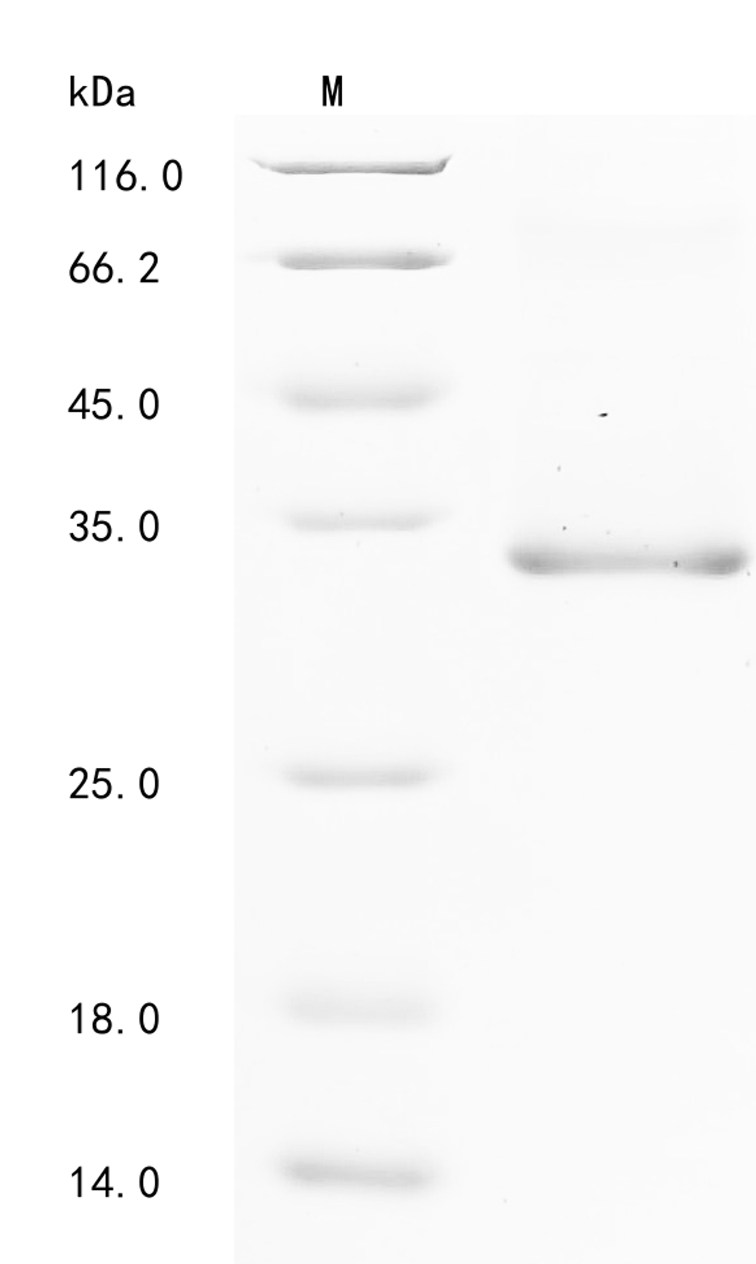 (Tris-Glycine gel) Discontinuous SDS-PAGE (reduced) with 5% enrichment gel and 15% separation gel.
