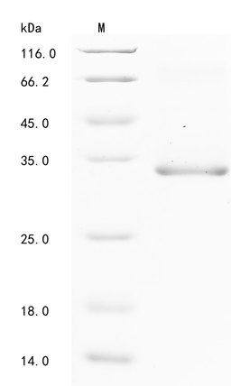 (Tris-Glycine gel) Discontinuous SDS-PAGE (reduced) with 5% enrichment gel and 15% separation gel.