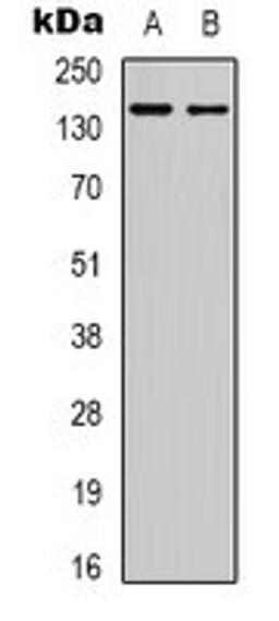 Western blot analysis of Hela (Lane 1), HuvEc (Lane 2) whole cell lysates using GPR126 antibody