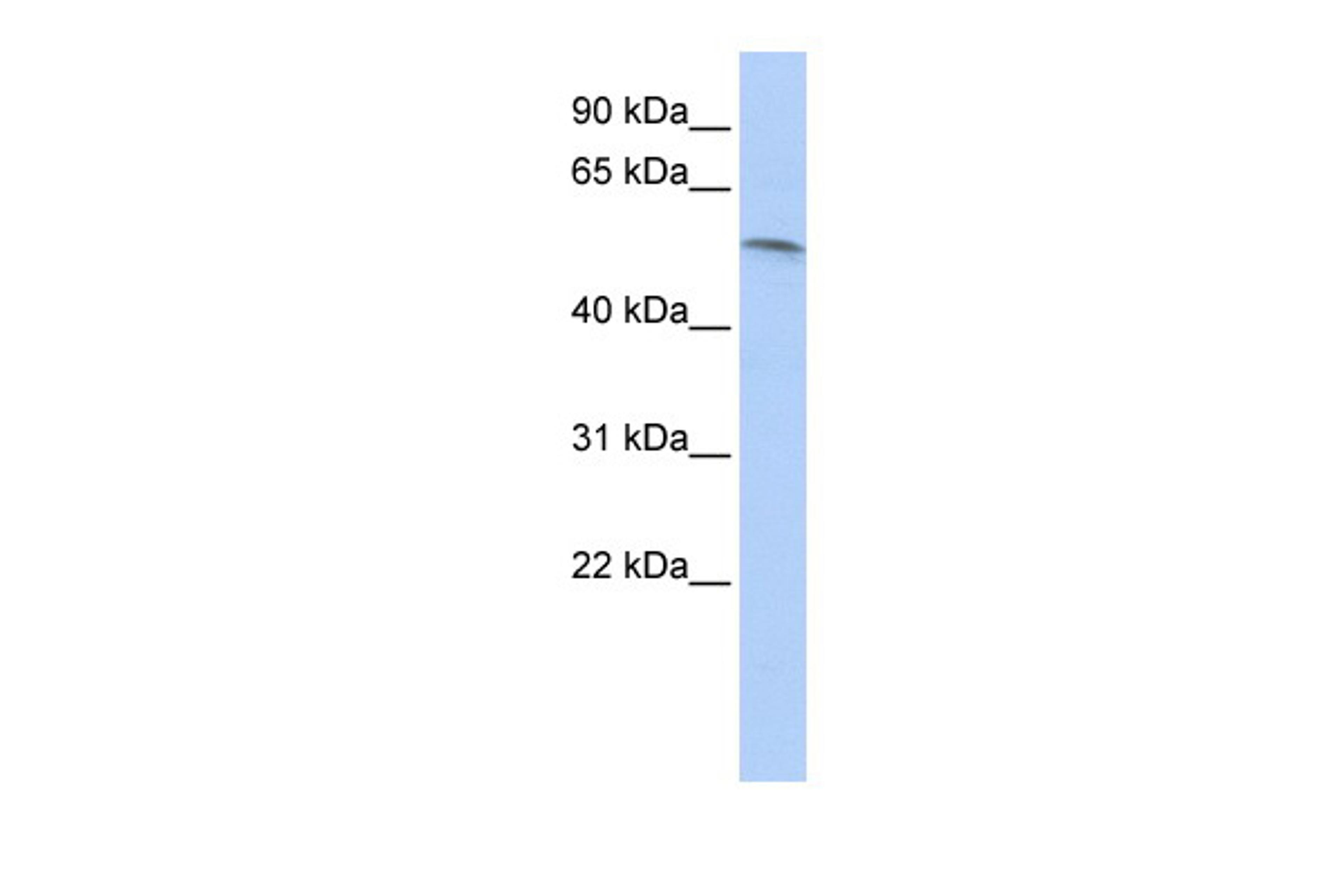 Antibody used in WB on Human HepG2 at 0.2-1 ug/ml.