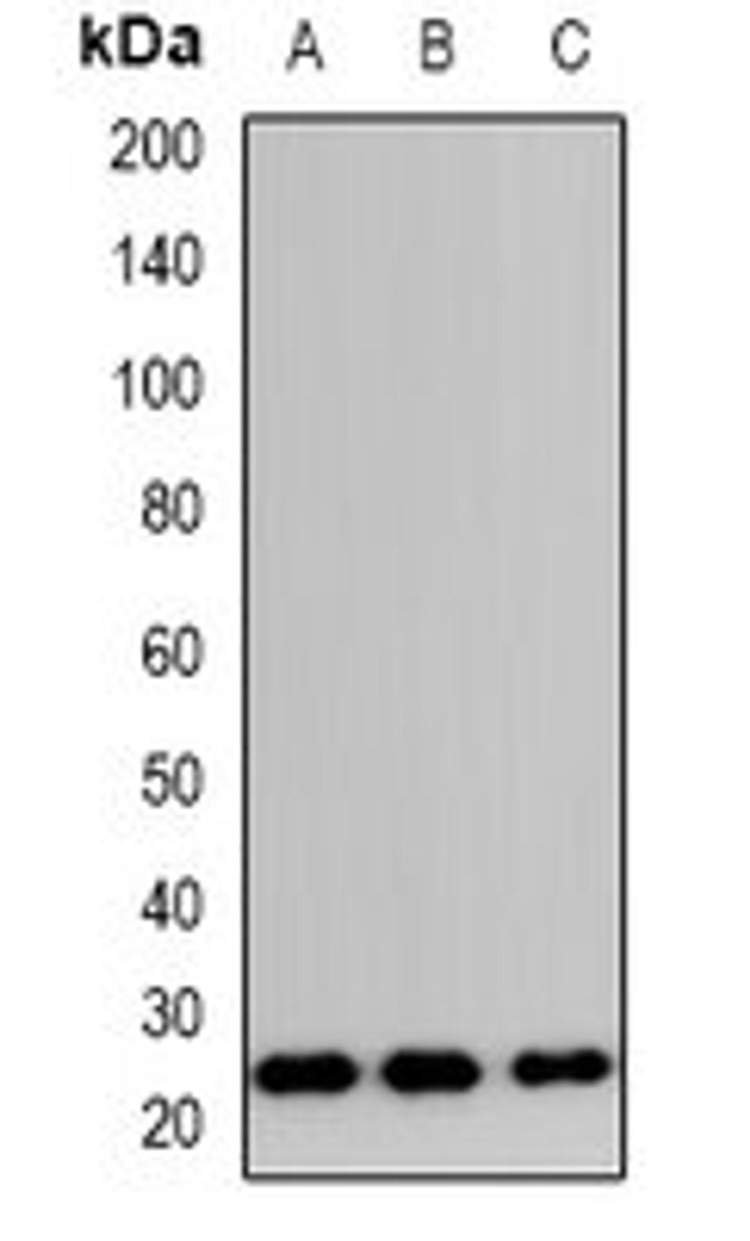 Western blot analysis of HeLa (Lane1), RAW264.7 (Lane2), H9C2 (Lane3) whole cell lysates using TP53INP2 antibody