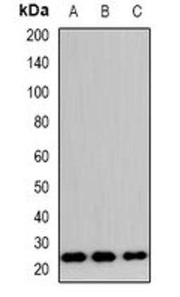 Western blot analysis of HeLa (Lane1), RAW264.7 (Lane2), H9C2 (Lane3) whole cell lysates using TP53INP2 antibody