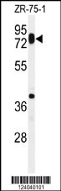 Western blot analysis of HAS1 Antibody in ZR-75-1 cell line lysates (35ug/lane)