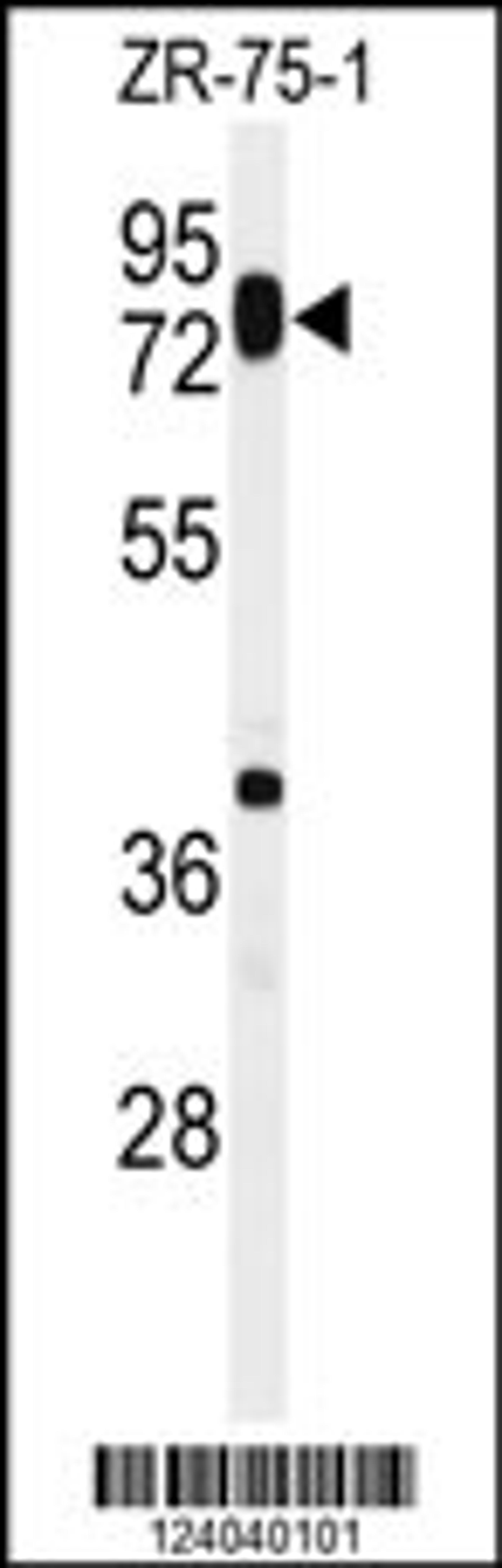 Western blot analysis of HAS1 Antibody in ZR-75-1 cell line lysates (35ug/lane)