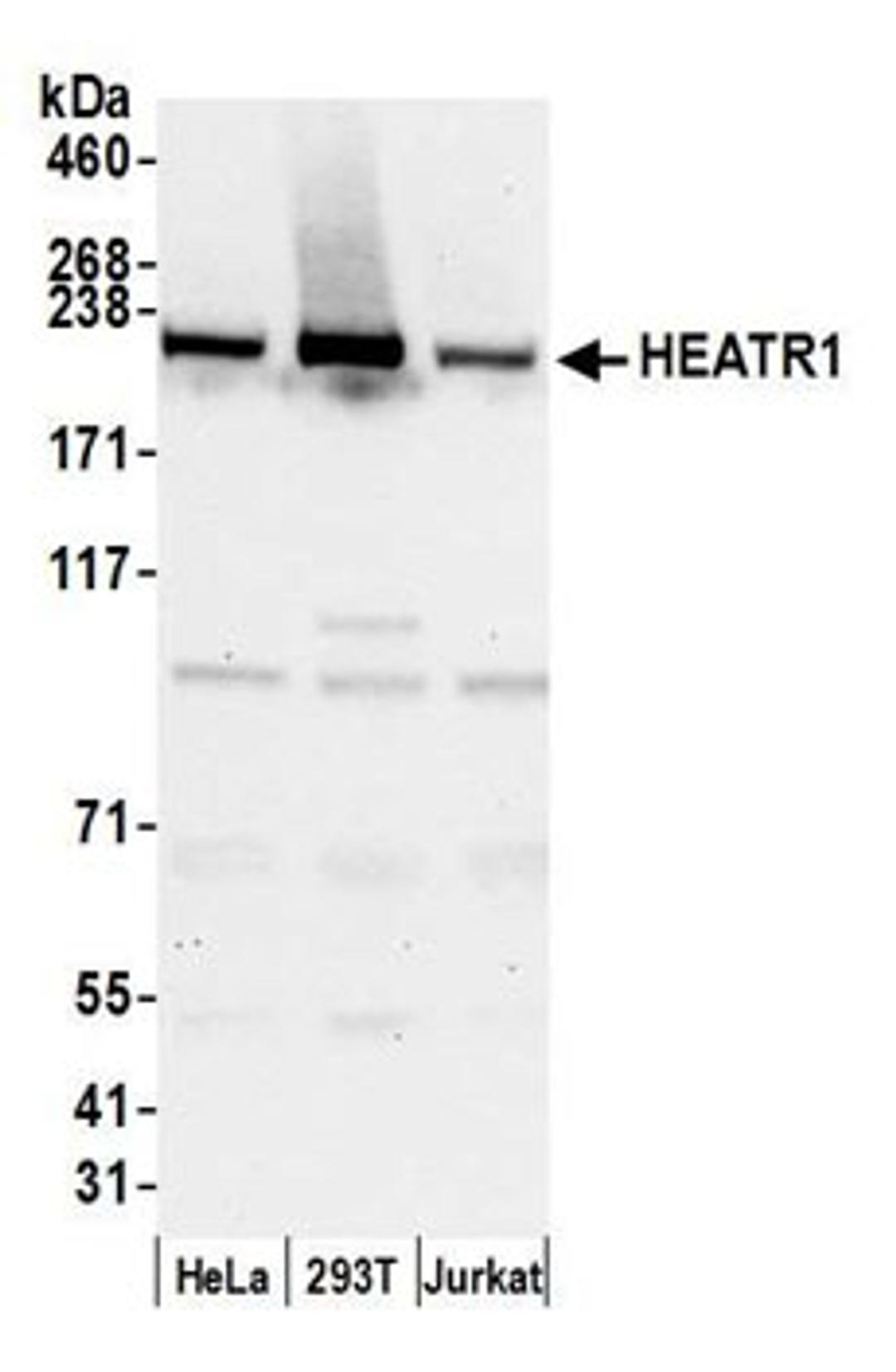 Detection of human HEATR1 by western blot.