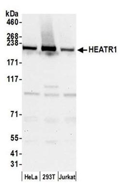 Detection of human HEATR1 by western blot.