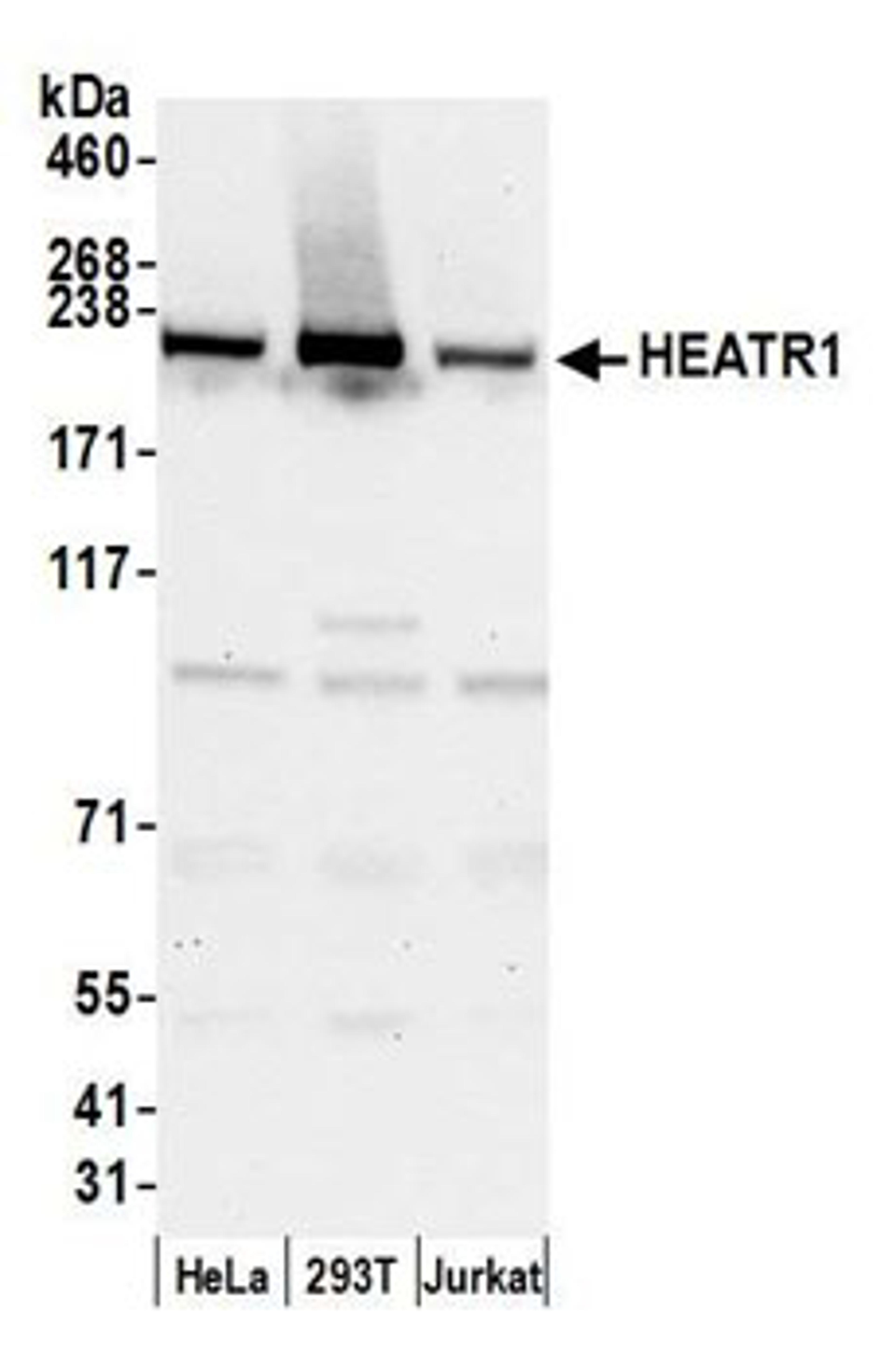 Detection of human HEATR1 by western blot.