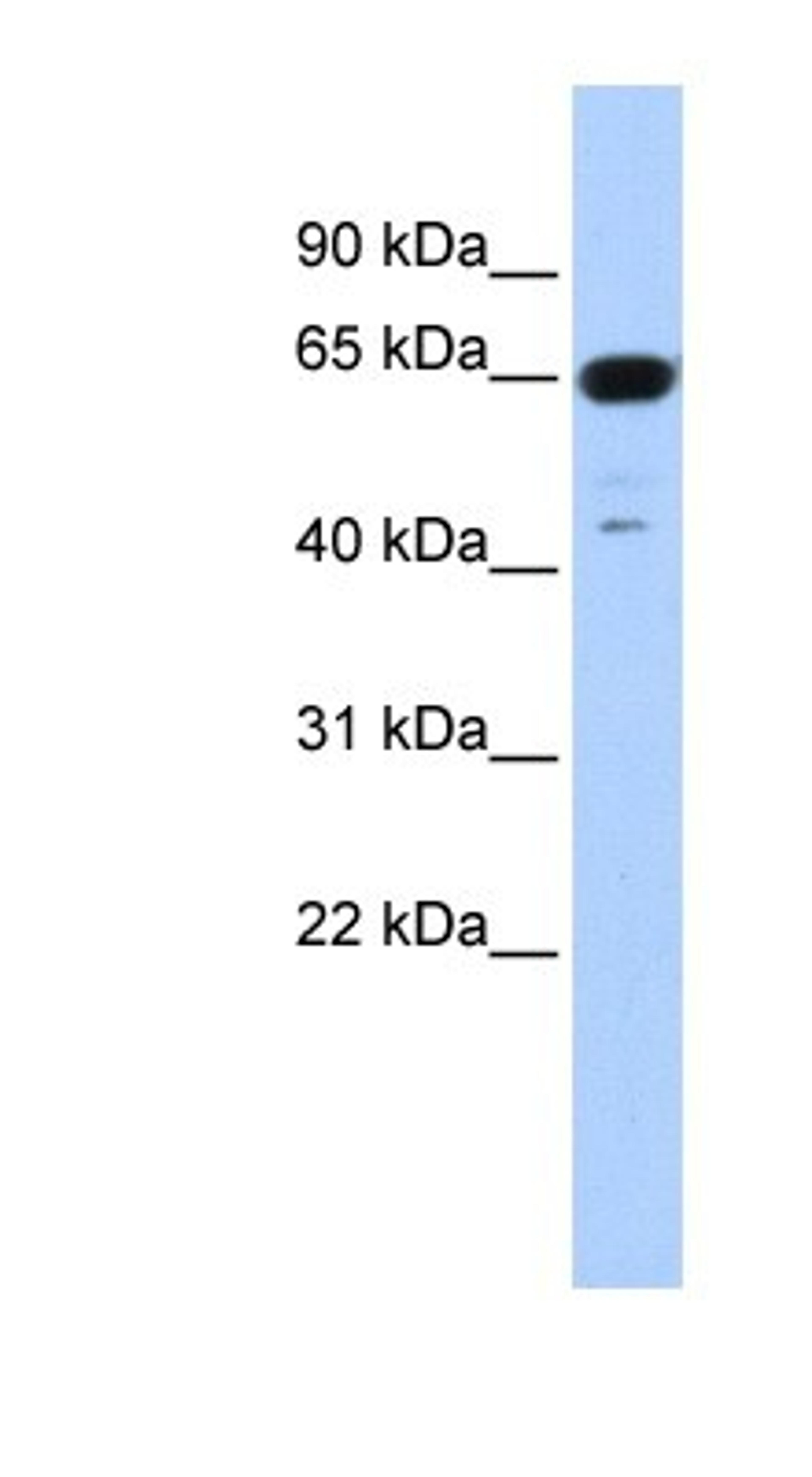 Western Blot: TRIM72 Antibody [NBP1-55029] - Human Muscle lysate, concentration 0.2-1 ug/ml.