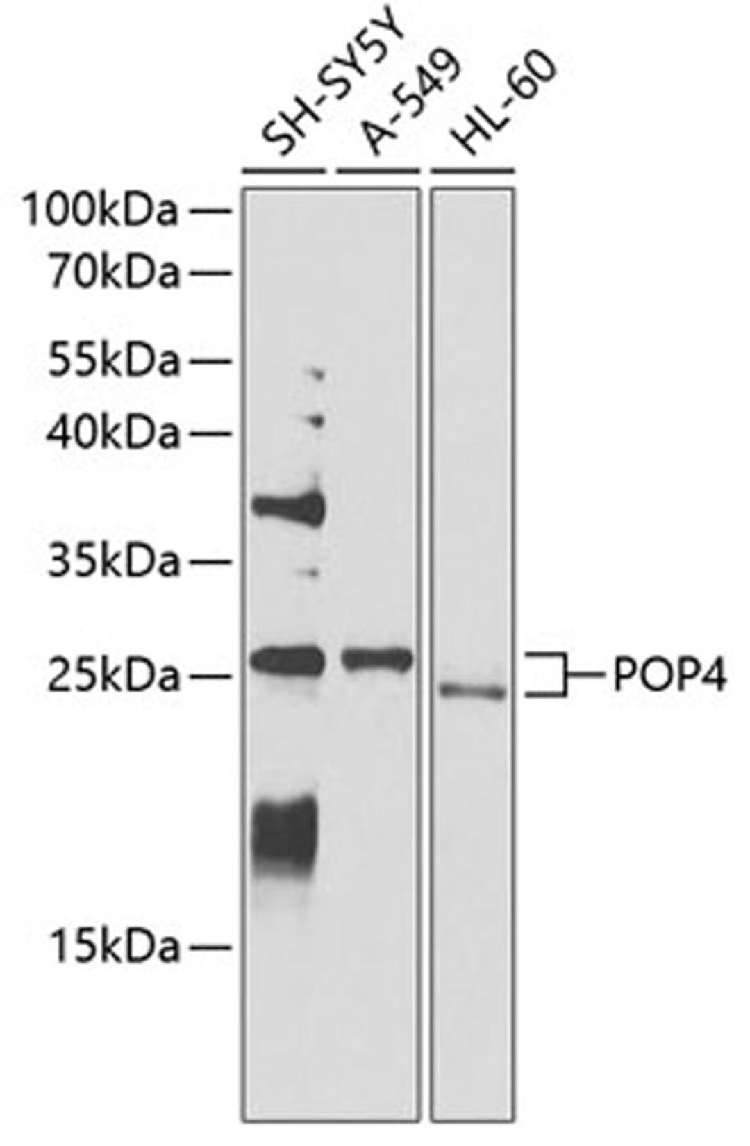 Western blot - POP4 antibody (A4452)