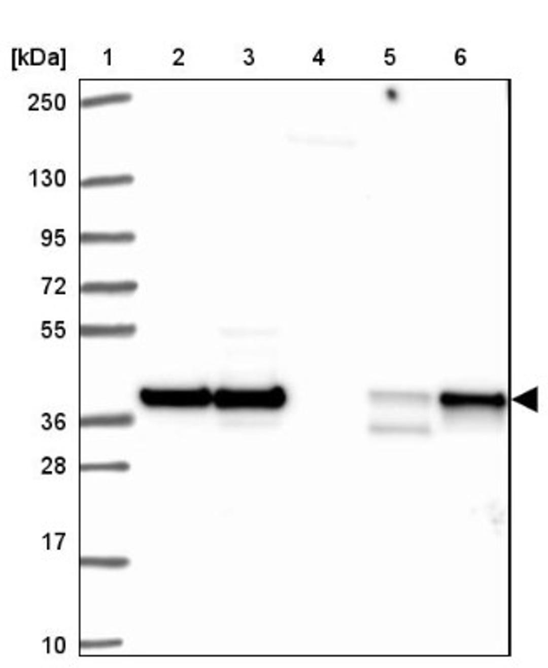 Western Blot: HNRPDL Antibody [NBP2-38806] - Lane 1: Marker [kDa] 250, 130, 95, 72, 55, 36, 28, 17, 10<br/>Lane 2: RT-4<br/>Lane 3: U-251 MG<br/>Lane 4: Human Plasma<br/>Lane 5: Liver<br/>Lane 6: Tonsil