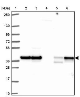 Western Blot: HNRPDL Antibody [NBP2-38806] - Lane 1: Marker [kDa] 250, 130, 95, 72, 55, 36, 28, 17, 10<br/>Lane 2: RT-4<br/>Lane 3: U-251 MG<br/>Lane 4: Human Plasma<br/>Lane 5: Liver<br/>Lane 6: Tonsil