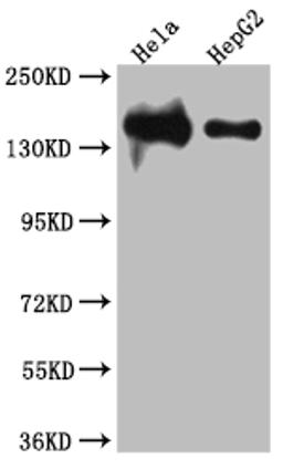 Western Blot. Positive WB detected in: Hela whole cell lysate, HepG2 whole cell lysate. All lanes: DNA Ligase I antibody at 1:1000. Secondary. Goat polyclonal to rabbit IgG at 1/50000 dilution. Predicted band size: 102, 89, 99 kDa. Observed band size: 140 kDa. 