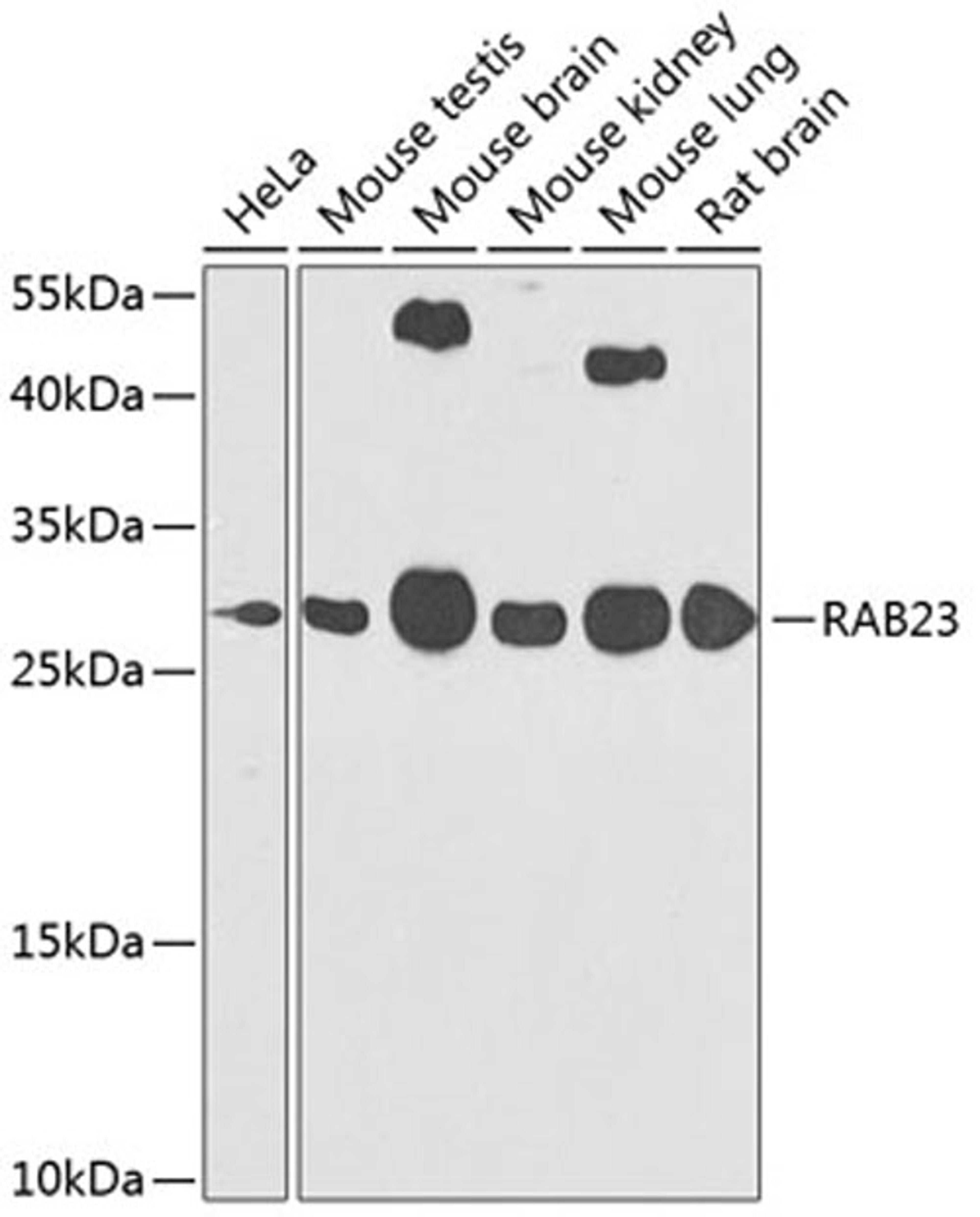 Western blot - RAB23 antibody (A7979)