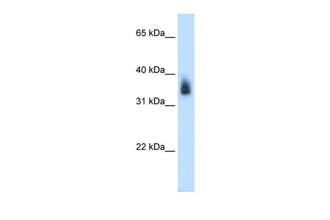 Antibody used in WB on Human Placenta at 0.2-1 ug/ml.