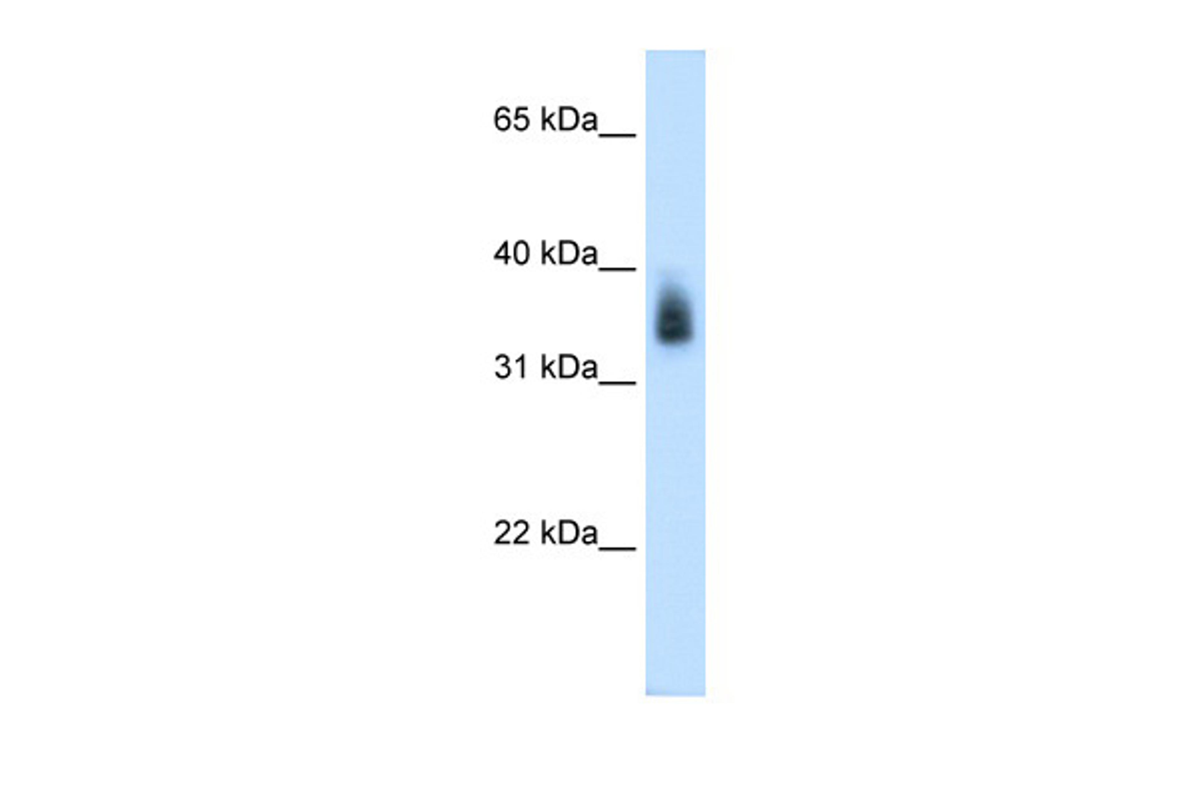 Antibody used in WB on Human Placenta at 0.2-1 ug/ml.