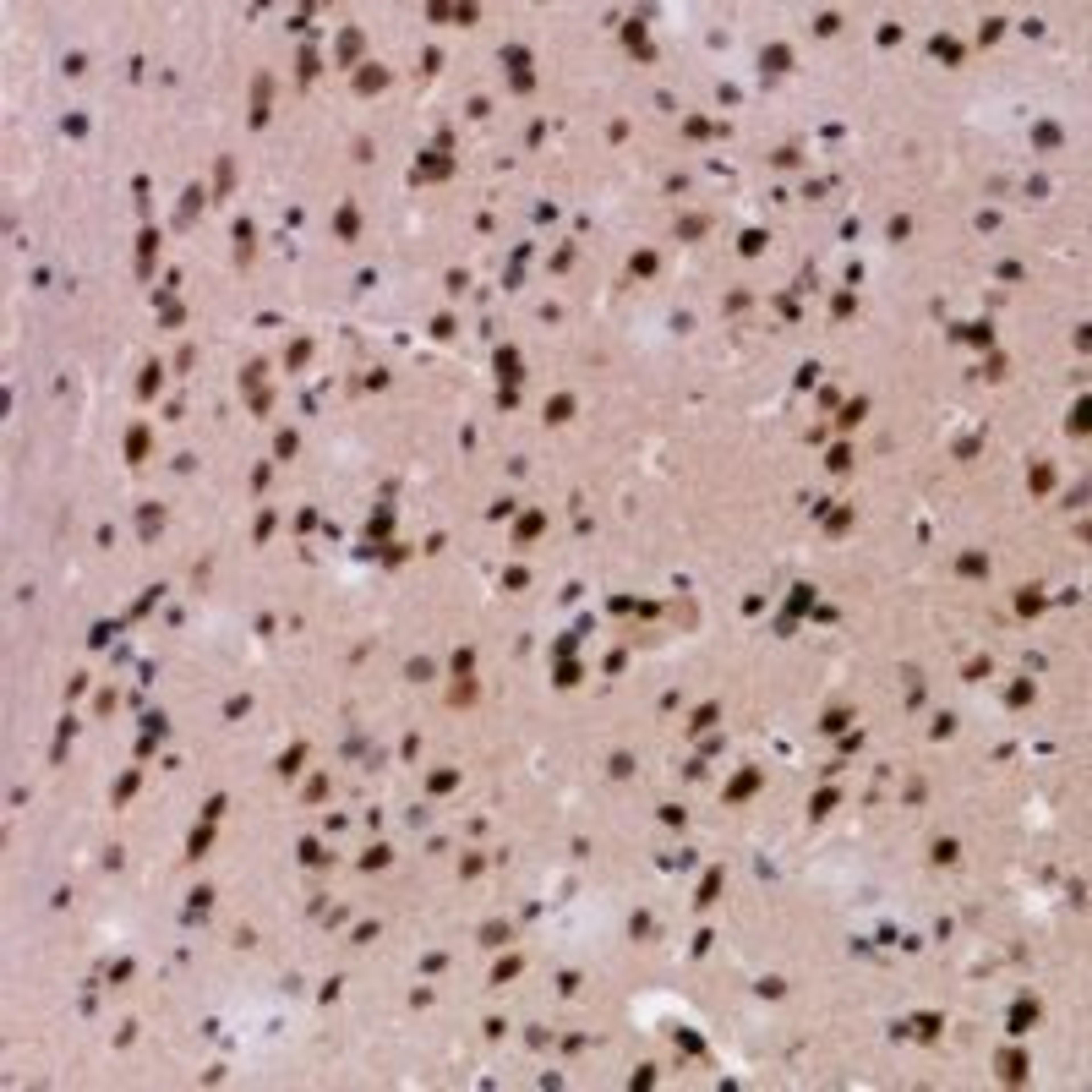 Immunohistochemical staining of human brain tissue using HBA1 antibody