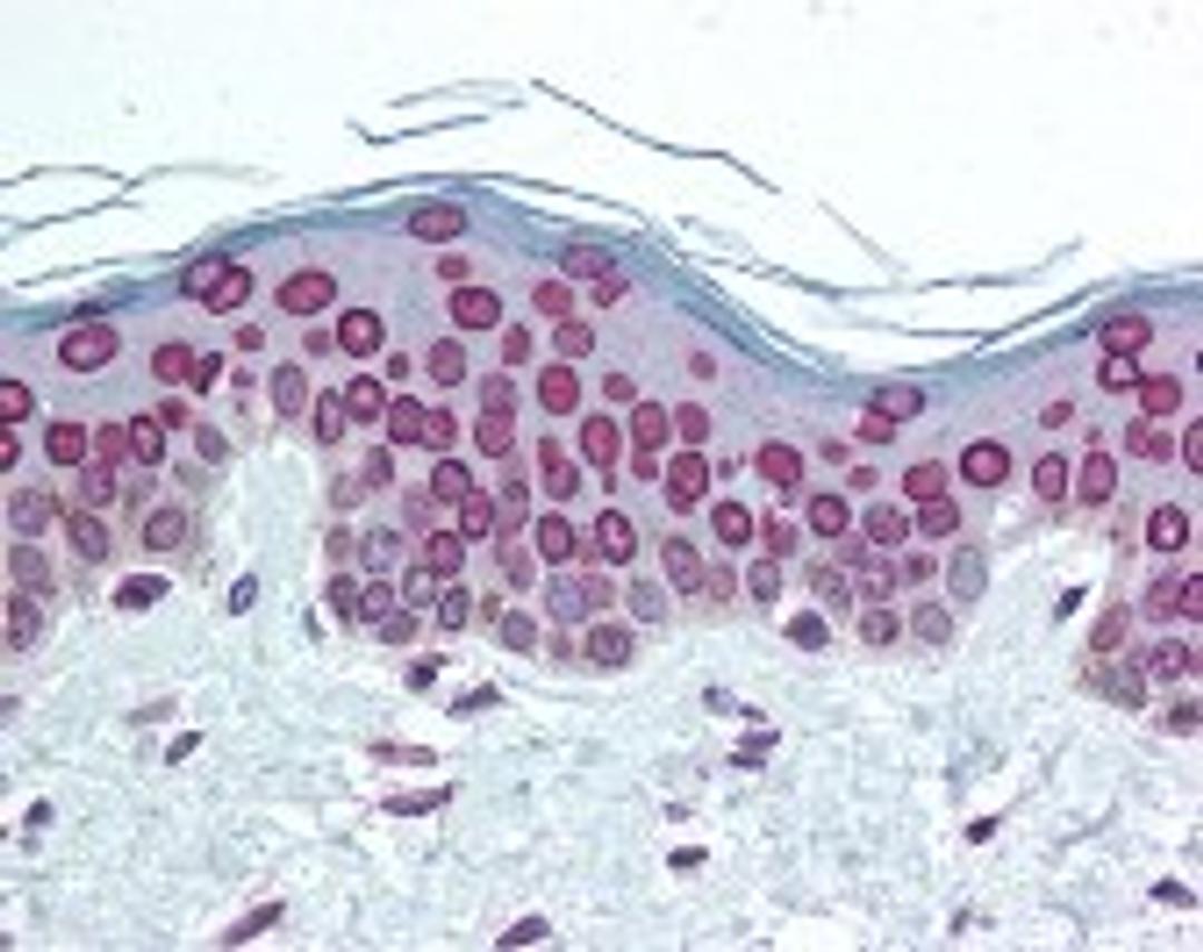 Immunohistochemistry staining of LMNA in skin tissue using LMNA Antibody.