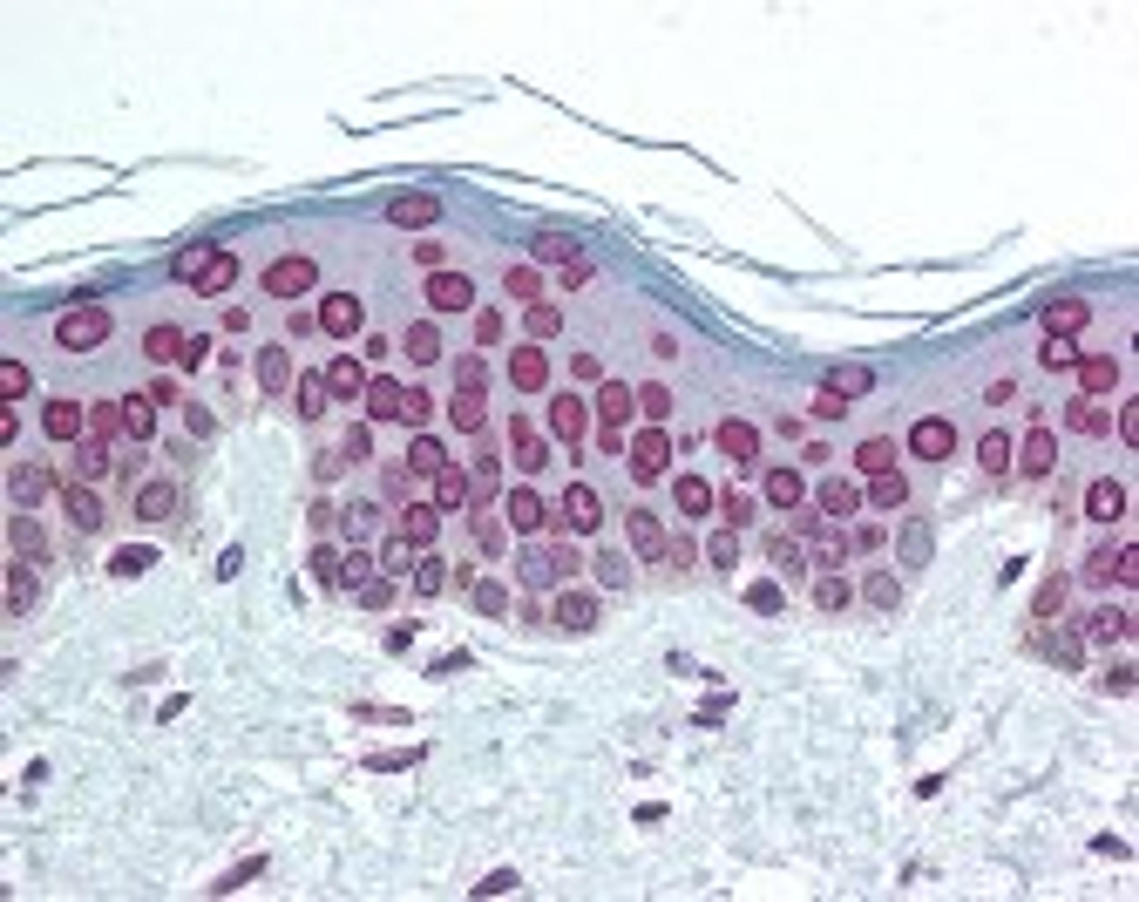 Immunohistochemistry staining of LMNA in skin tissue using LMNA Antibody.