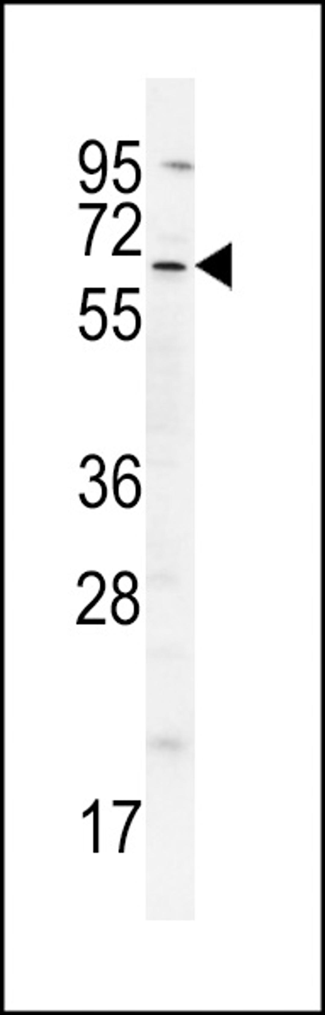 Western blot analysis in A549 cell line lysates (35ug/lane).