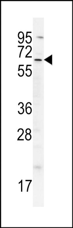 Western blot analysis in A549 cell line lysates (35ug/lane).