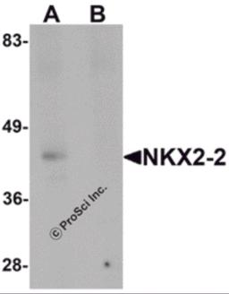 Western blot analysis of NKX2-2 in rat kidney tissue lysate with NKX2-2 antibody at 1 &#956;g/mL in (A) the absence and (B) the presence of blocking peptide.